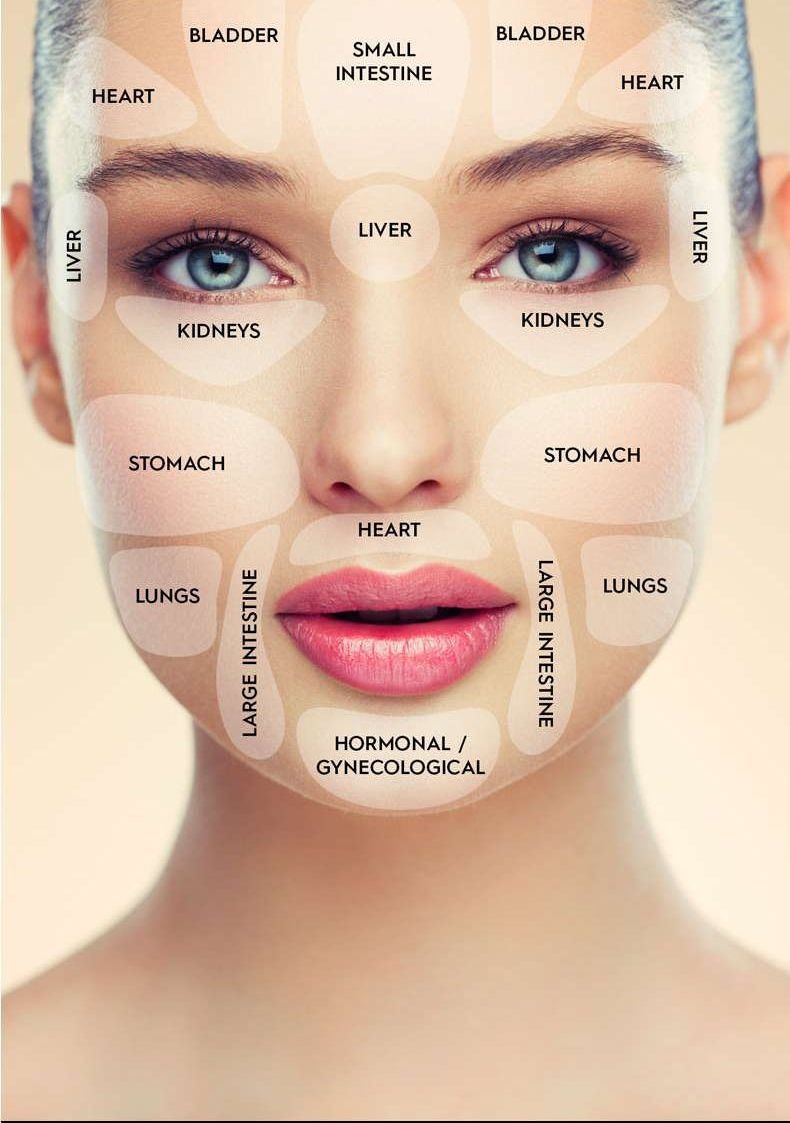 face acne map